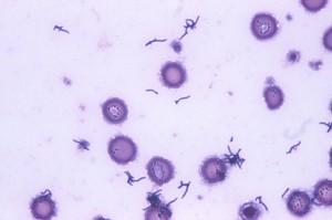 propionibacterium_acnes